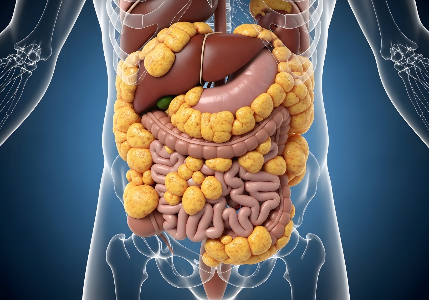 3D medical illustration showing visceral fat accumulation and yellow adipose tissue surrounding internal organs within the abdominal cavity